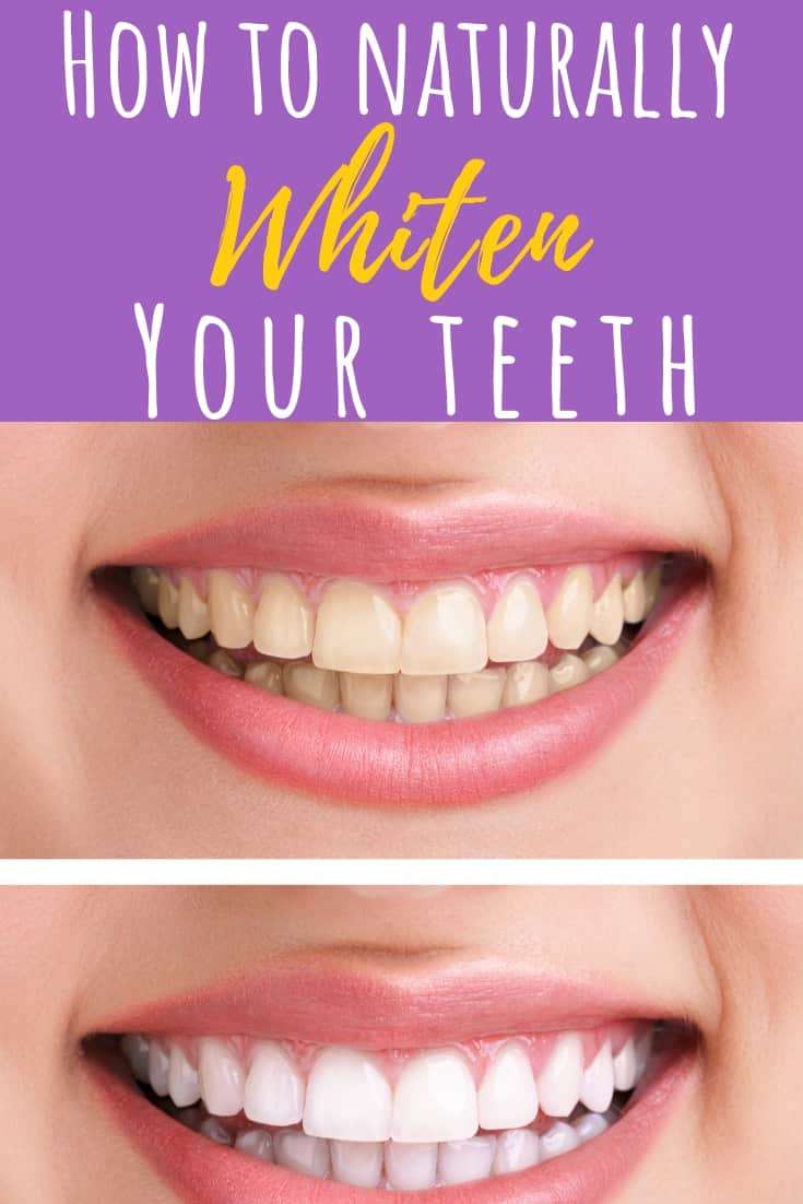 4 Natural DIY Teeth Whitening Recipes